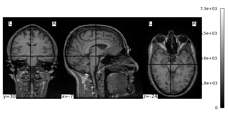 ../_images/e8796deaad528ecd597ec43a4419ea86a6f3e3015899c6067d6946cb28aa7bd0.png