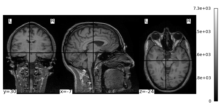 ../_images/ed4f55051f9bf08be3898877a40b395da656c3541c5be345e819d4d19ce2eefa.png