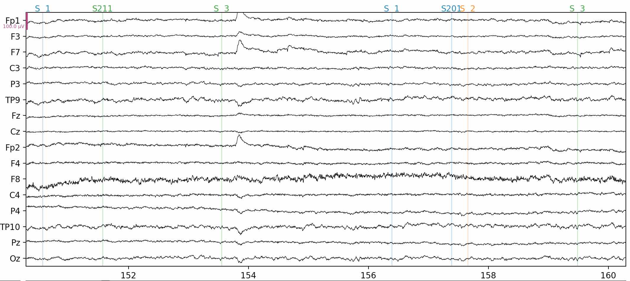 Sample EEG data