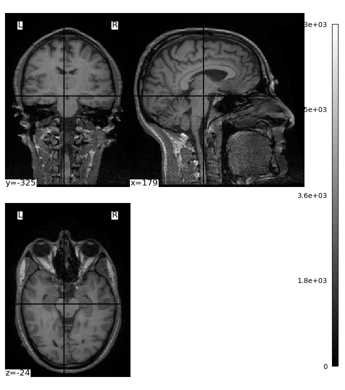 <Figure size 670x760 with 5 Axes>