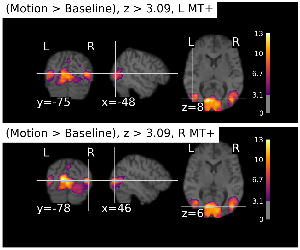 <Figure size 1200x1000 with 10 Axes>