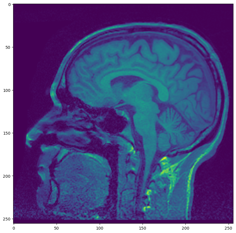 <Figure size 1000x1000 with 1 Axes>