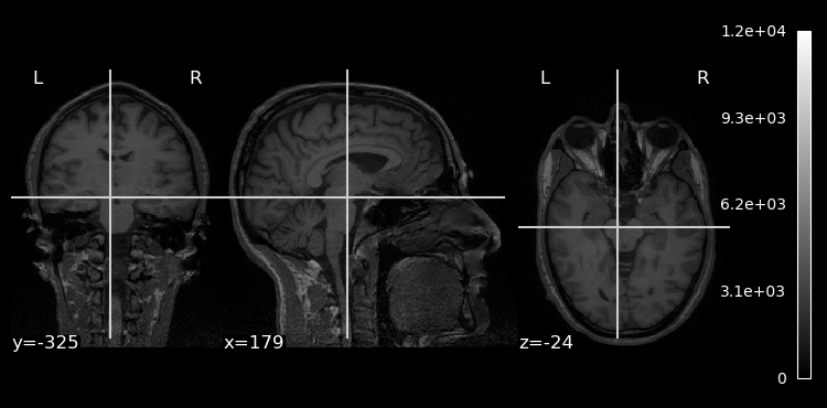 <Figure size 730x350 with 5 Axes>