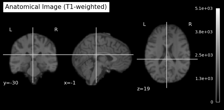 <Figure size 730x350 with 5 Axes>