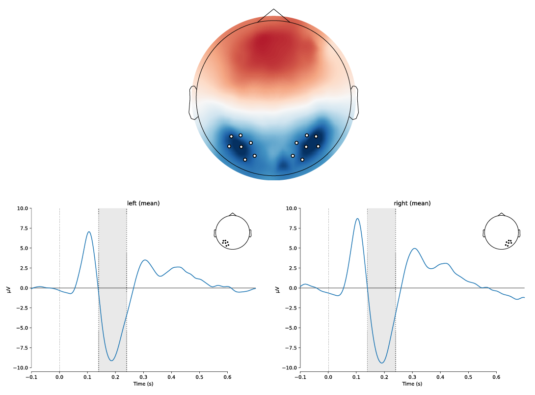 An example ERP component, the N170. The top panel the distribution of electrical potentials over the scalp (viewed from above, with the nose at the top), averaged over the time period 165-215 ms after stimulus onset. The bottom panels show the time course of the ERP elicited by printed words, averaged over the electrodes indicated by the white dots in the top panel. The vertical line represents stimulus onset, and the shaded grey area indicates the time over which the data were averaged to generate the scalp topographic map. The data are from Galilee et al. (under review).