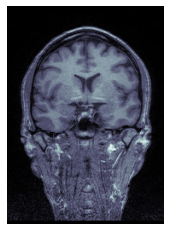 <Figure size 432x288 with 1 Axes>