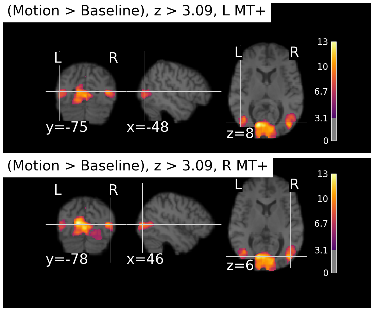 <Figure size 1200x1000 with 10 Axes>