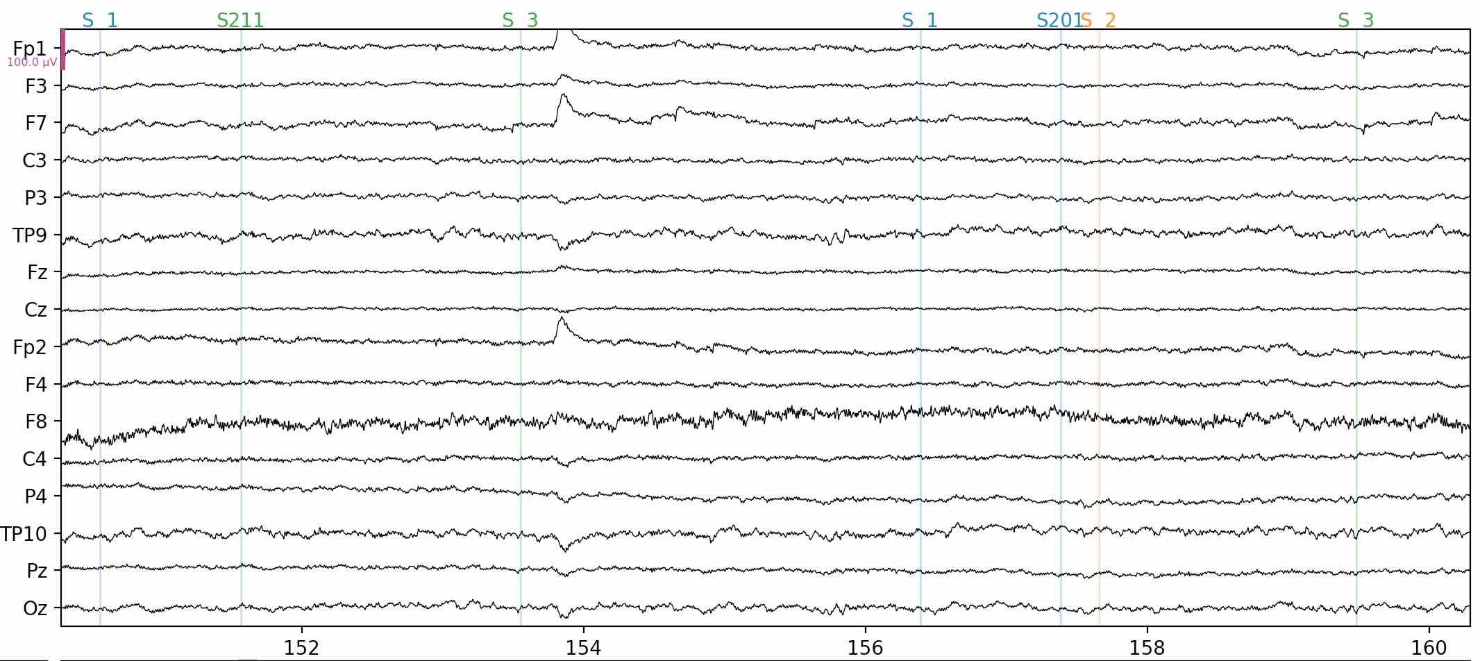 Sample EEG data from 16 electrodes, over a period of 10 s.