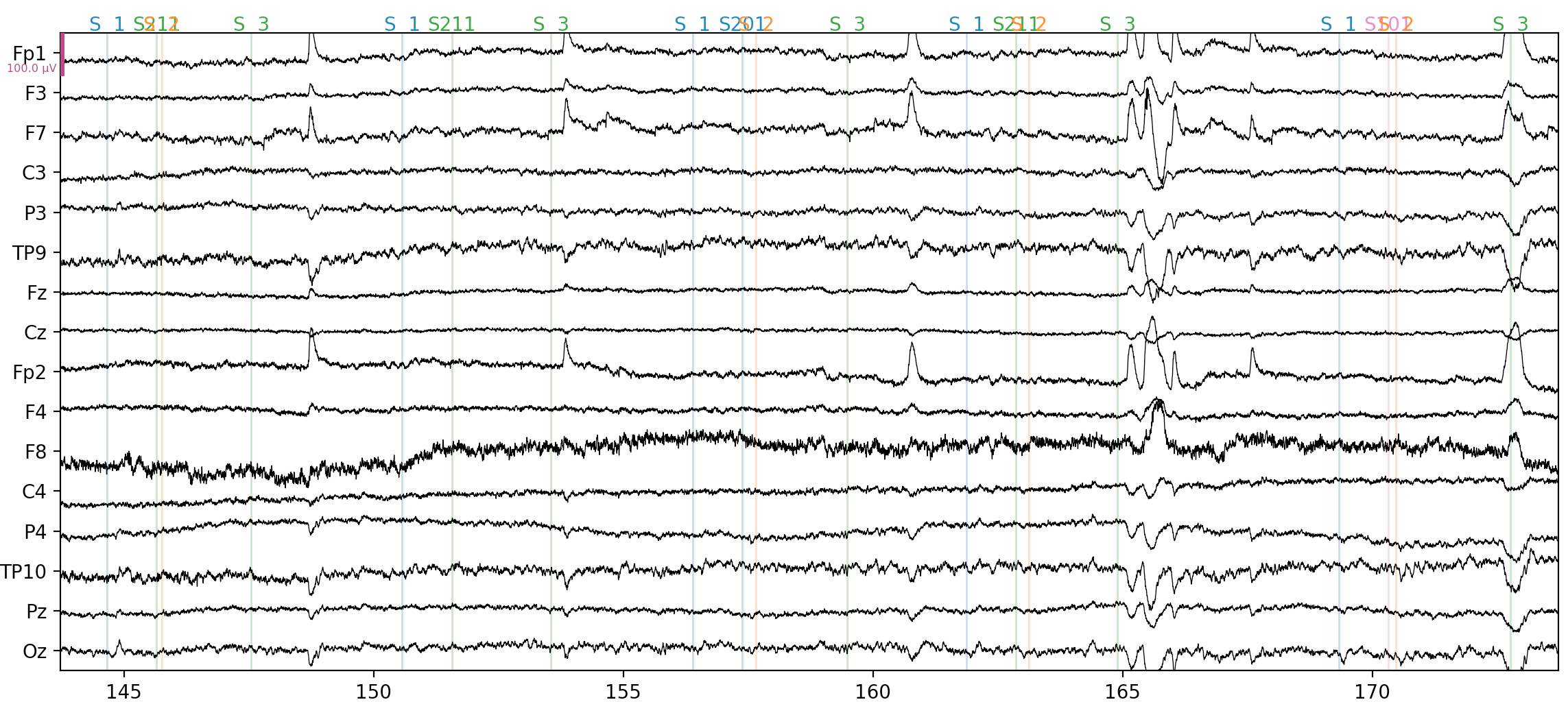 A 30 s sample of continuous EEG data, visualized in the time domain.